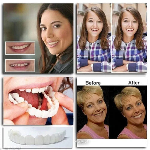 Oralux Snap On Dentures