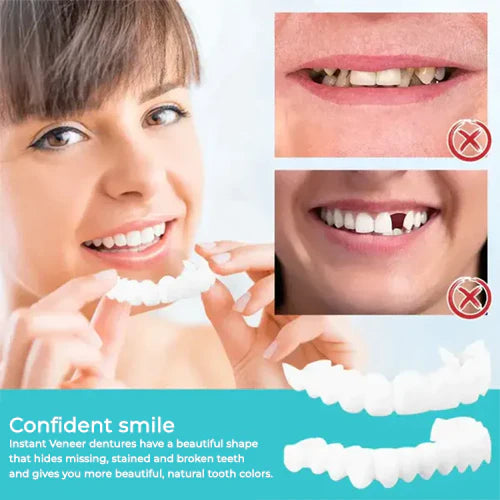 Oralux Snap On Dentures